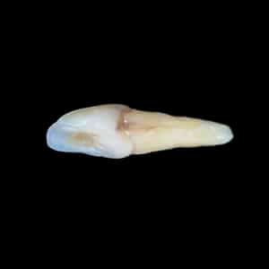 resin_2